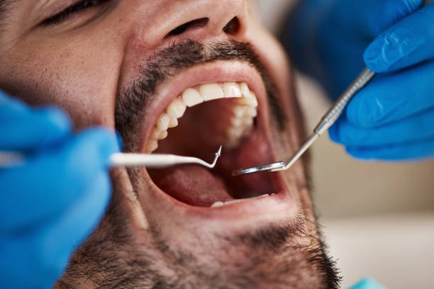 Best Emergency Denture Repair in Radford, VA
